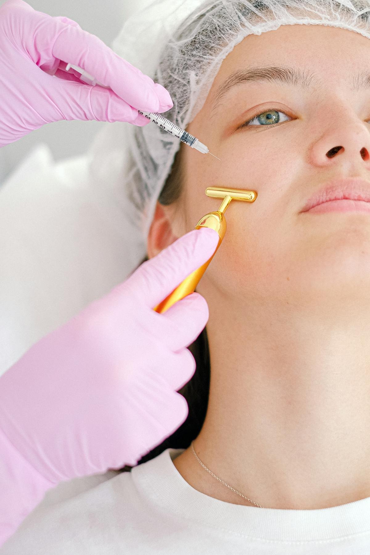 Mesoterapia y Microneedling